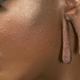 Image for article titled A Rather Unique Coming Out on Dr. Pimple Popper